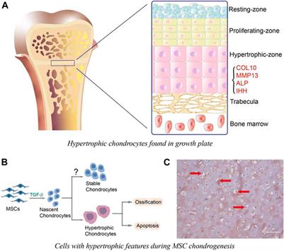 Role of Canonical Wnt/β-Catenin Pathway in Regulating Chondrocytic Hypertrophy in Mesenchymal Stem Cell-Based Cartilage Tissue Engineering